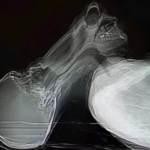 Never Lie, Never Die