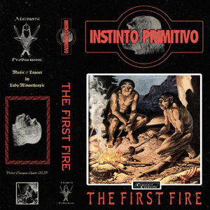 Dupuytren's contracture