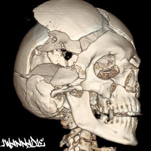 iWannaDie (feat. GOT2GO)