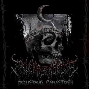 Delusional Parasitosis