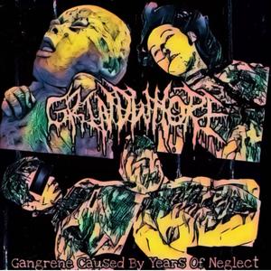 Gangrene Caused By Years Of Neglect