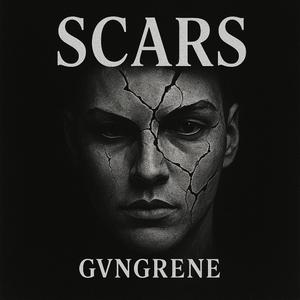 SCARS
