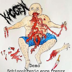 Caillous Botched Rectal Circumsision