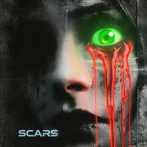 SCARS