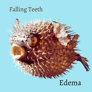 Edema