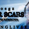 Foegz - Foegz War Scars (feat. Spb newborn)