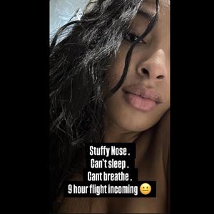Stuffy Nose (Callin)