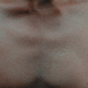 velvet woundsϛ