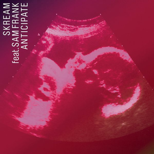 Anticipate (Netsky Remix)