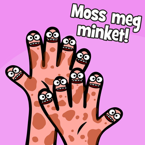 Moss meg minket!