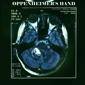 Twenty-one kilotons brain tumor