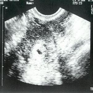 창백한 푸른 점  (feat. 김한준) (Pale Blue Dot  (feat. Kim Han Jun))