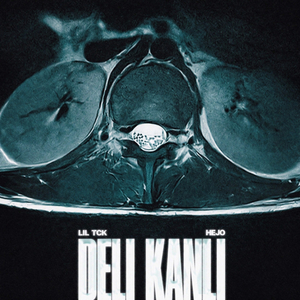 DELİ KANLI