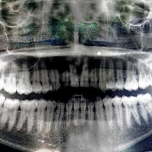 Salahkah (Tsabit Ikbar)