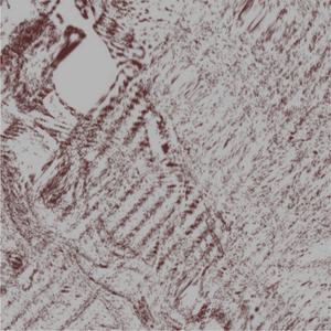 CENTIPÈDES (feat. Dioleor)