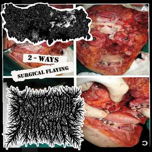 Fetal Necrobiosis Lipoidica