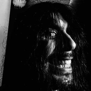 Pseudobulbar Affect (PBA)