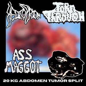 Pneumonoultramicroscopicsilicovolcanoconiosis