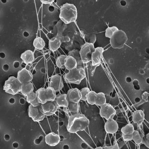 肿瘤（prod.by Jeston）