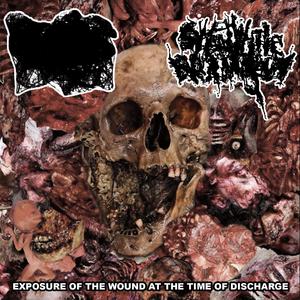 Thick Yellowing Conjunctivitis and Desiccation