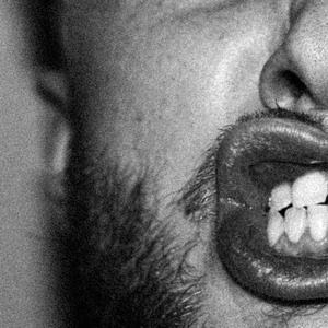Diastema