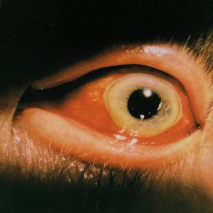 Vivisection