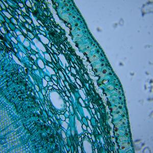 Prima o poi il petrolio finirà (feat. El Lorens) (Remastered)