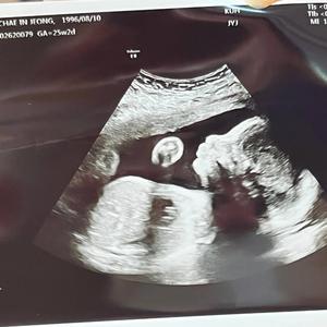 채채야 엄마한테 고마워해라