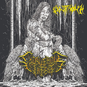 Cerebellar Vermis Hypoplasia with Cysts of the Posterior Trench