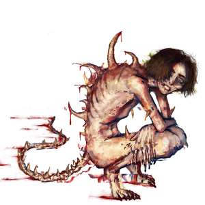 neuronprolapse