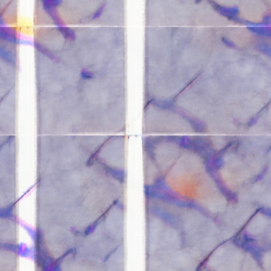 Neuronal
