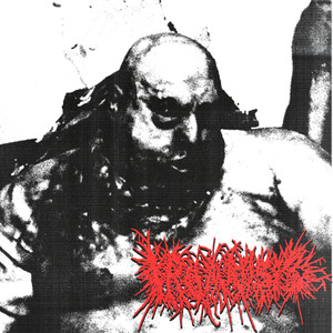 Guy Throws Cigarrete onto Gas Station and Everyones Burnt to Crisps (Peptic Ulcer)