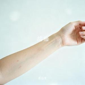 结痂