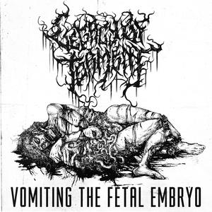 Vomiting the Fetal Embryo