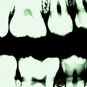 The Spiritual Offensive