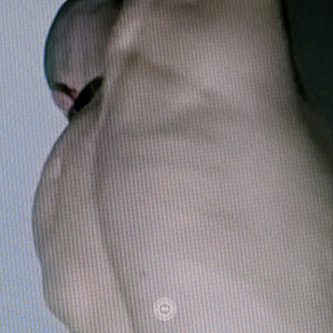 III XVIII XII II III