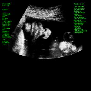 Kokomo (The Suicide of Western Culture Remix)