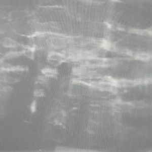 Fake Plastic Trees(Radiohead Cover)