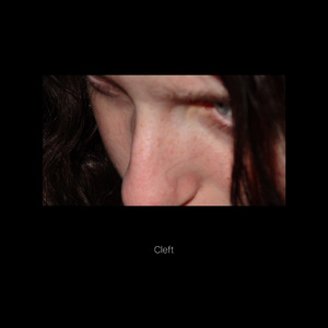 Cleft
