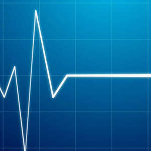 Реанимация