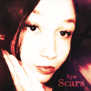 Scars