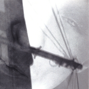 010101010101010101010101