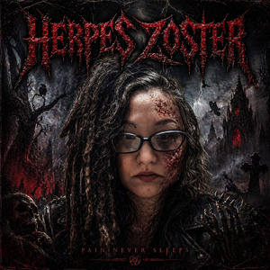 Herpes Zoster