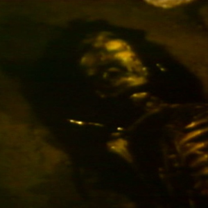 Putrefaction