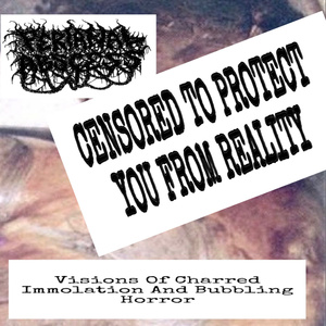 CASE OF WIDESPREAD CUTANEOUS AND SUBCUTANEOUS NECROSIS SECONDARY TO THERMAL TRAUMA