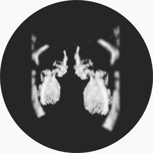 Same Blood (Post Scriptum Remix)