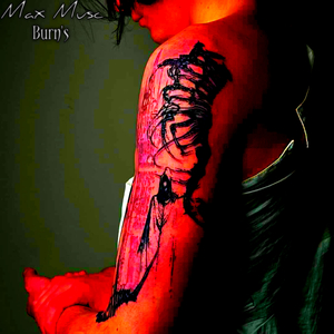 Burn's
