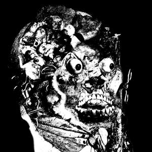 Swimming Pool Filter Induced Transrectal Evisceration