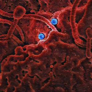 I hate updates they are viruses and very bad for my brain and the computer