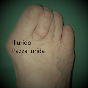 Pazza Lurida